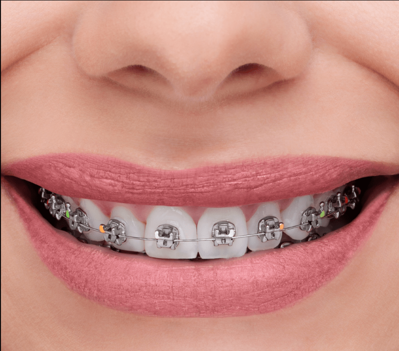 BRACKET UCLIP ROTH