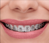 BRACKET UCLIP ROTH