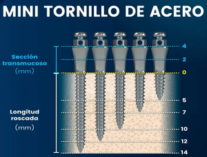 MINITORNILLO ACERO 7, 12 Y 14