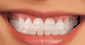 BRACKET SAFIRO