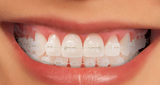 BRACKET SAFIRO