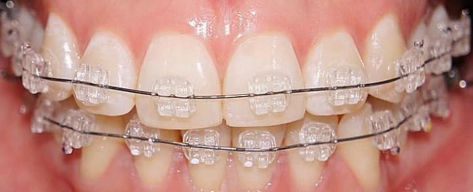 BRACKET SAFIRO