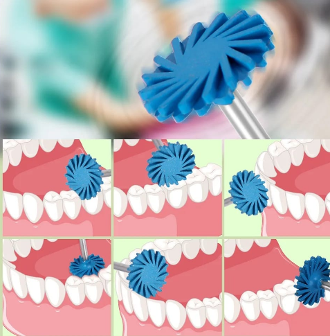 KIT CAUCHO DE PULIDO ESPIRAL  AZDENT