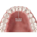 RETENEDOR DENTAL - LINGUAL X 10 UNID